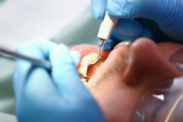 Best Holiday Emergency Dentist in Elwood, IL