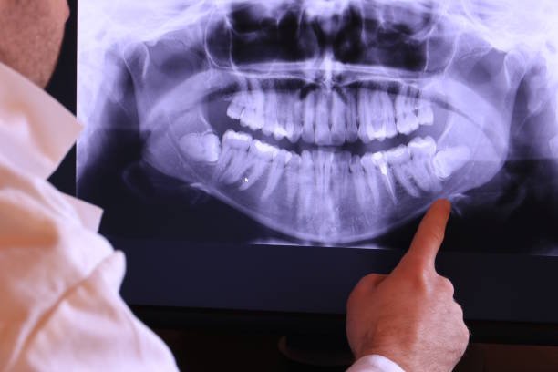 Best Pediatric Emergency Dentist in Elwood, IL