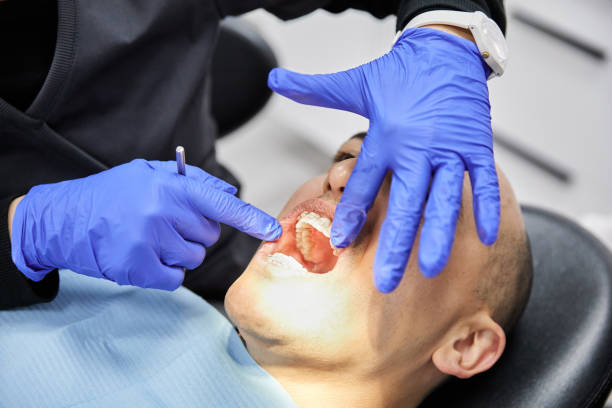 Best Emergency Dentist for Knocked-Out Tooth in Elwood, IL